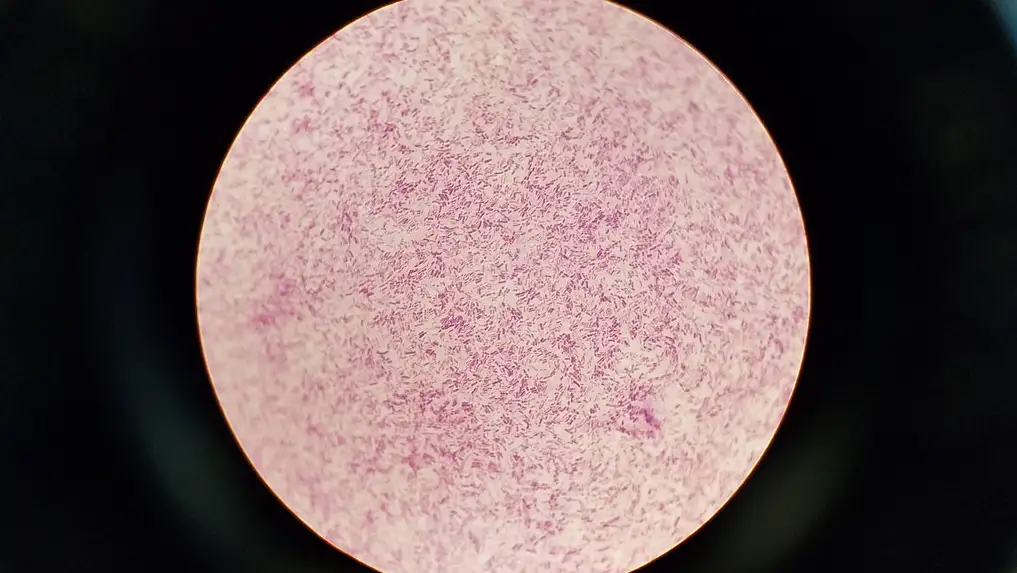 quiz image